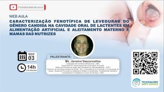 03/11- Prevalência de Candida Spp na Cavidade Oral de Lactentes Amamentados X Alimentação Artificial